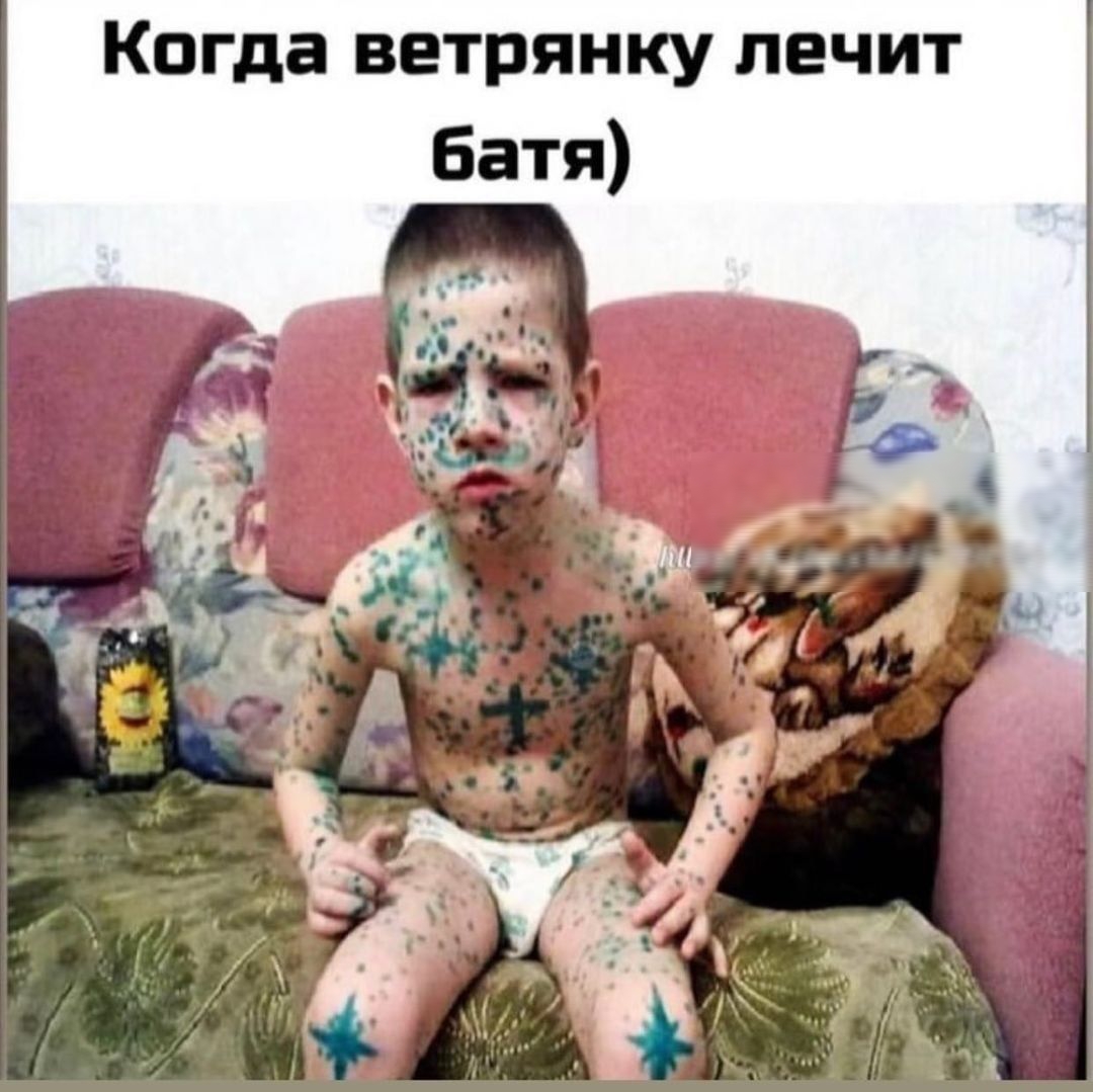 Когда ветрянку лечит Батя