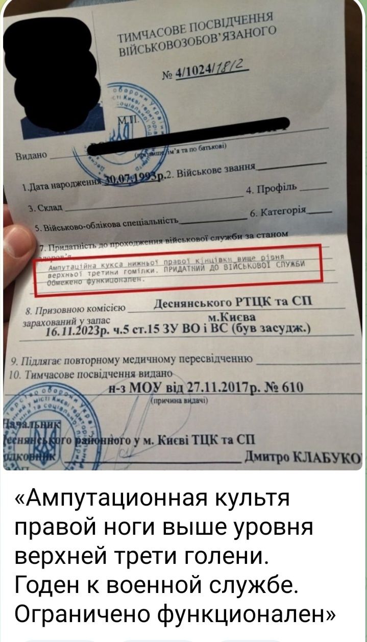 ДеспяппмпоРТЦК псп и ницы 2ЪЁ121 ч Би и во щ Буьпчудж ппипгтмщ жди Аш іщмымеиию _ вишп Ампутационная культя правой ноги выше уровня верхней трети голени Годен к военной службе Ограничено функционален