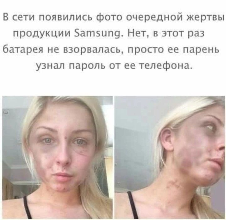 В сети появились фото очередной жертвы продукции Батзипв Нет в этот раз батарея не взорвалась прос го ее парень узнал пароль от ее телефона