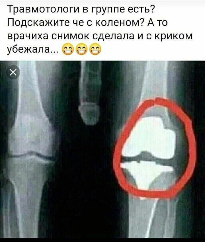 Травмотопоги в группе есть Подскажите че с коленом А то врачиха снимок сделала и с криком убежала гт гт ст