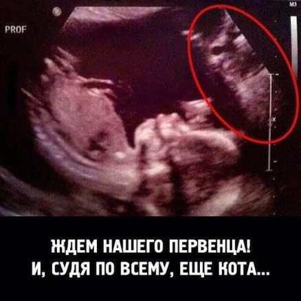 __ ЖДЕМ НАШЕГО ПЕРВЕИЩ И судя ПО ВСЕМУ ЕЩЕ ЮТА