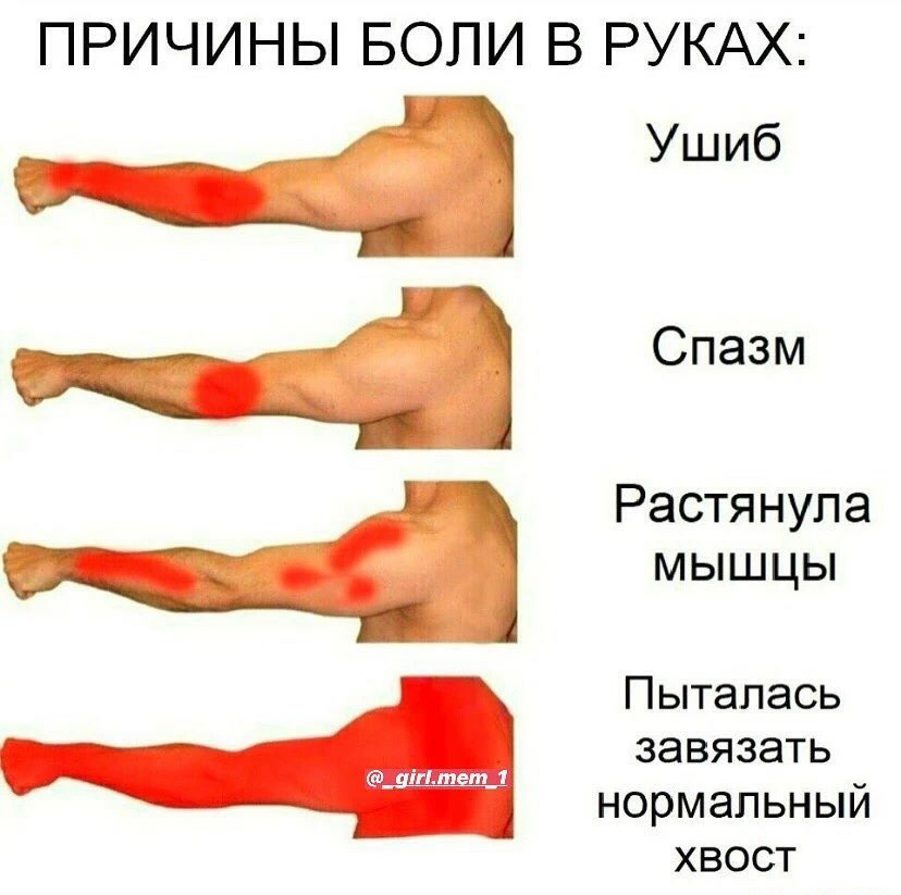 ПРИЧИНЫ БОЛИ В РУКАХ Ушиб Спазм Растянула мышцы Пьпалась завязать нормальный хвост МЦ