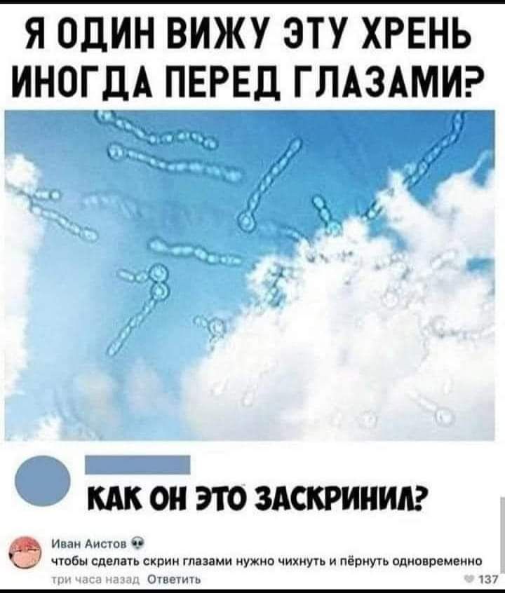 Я ОДИН ВИЖУ ЭТУ ХРЕНЬ ИНОГДА ПЕРЕД ГЛАЗАМИ _ Ш 0 ЭТО ЗАСКРИИИА ииииииииии бр ими и шуч мною ницы