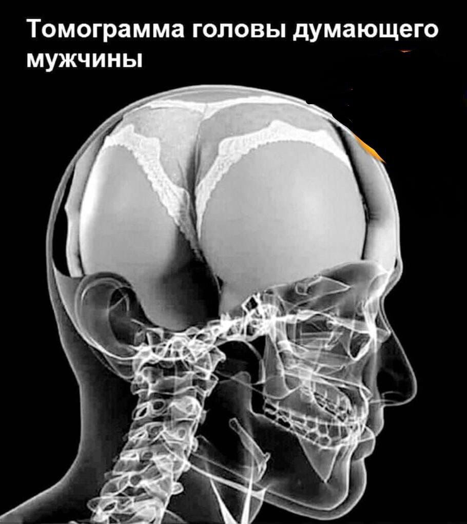 Томограмма ГОЛОВЫ думающего МУЖЧИНЫ