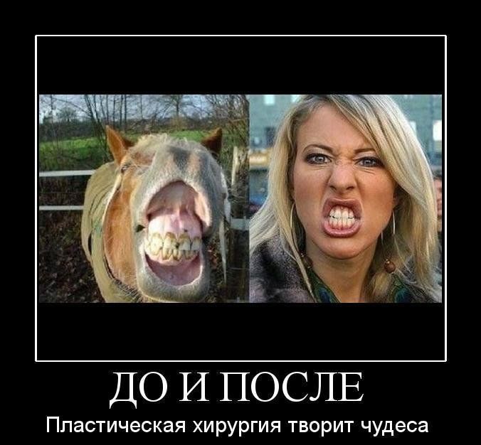 ДО И ПОСЛЕ Пластическая хирургия творит чудеса