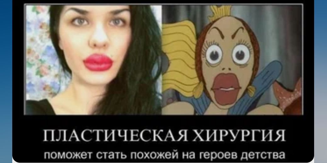 ПЛАСТИЧЕСКАЯ ХИРУРГИ Я _ поможеу ешь похожей на героев пешва