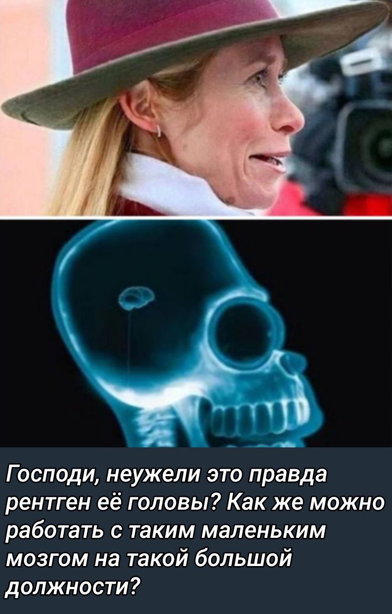 Господи, неужели это правда рентген её головы? Как же можно работать с таким маленьким мозгом на такой большой должности?