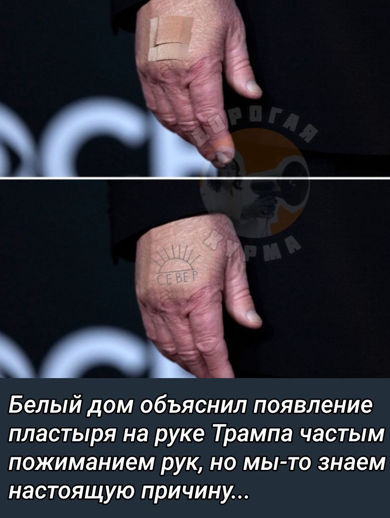 Белый дом объяснил появление пластыря на руке Трампа частым похиманием рук, но мы-то знаем настоящую причину...