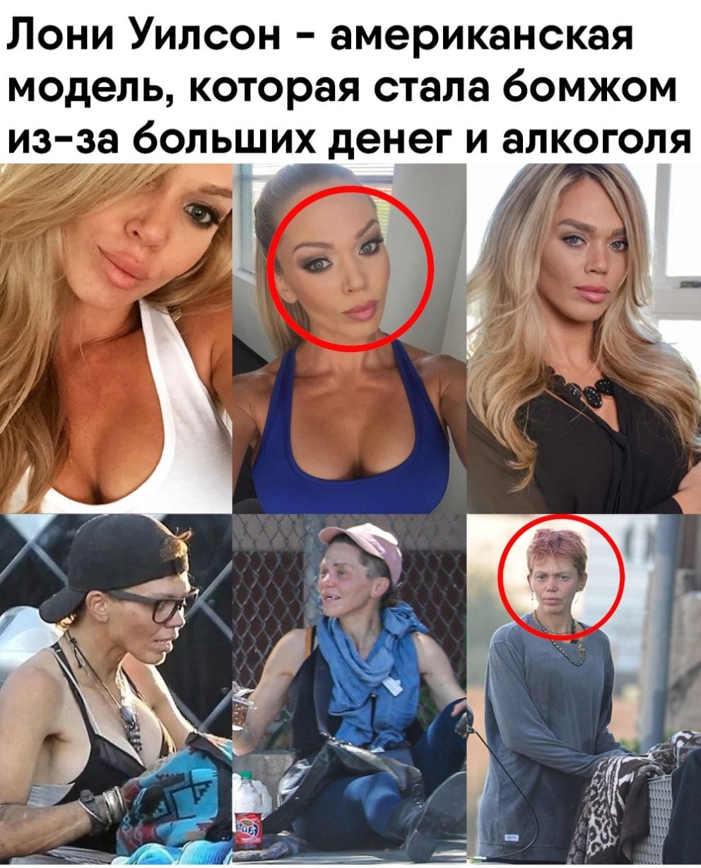 Лони Уилсон американская модель которая стала бомжом из за больших денег и алкоголя