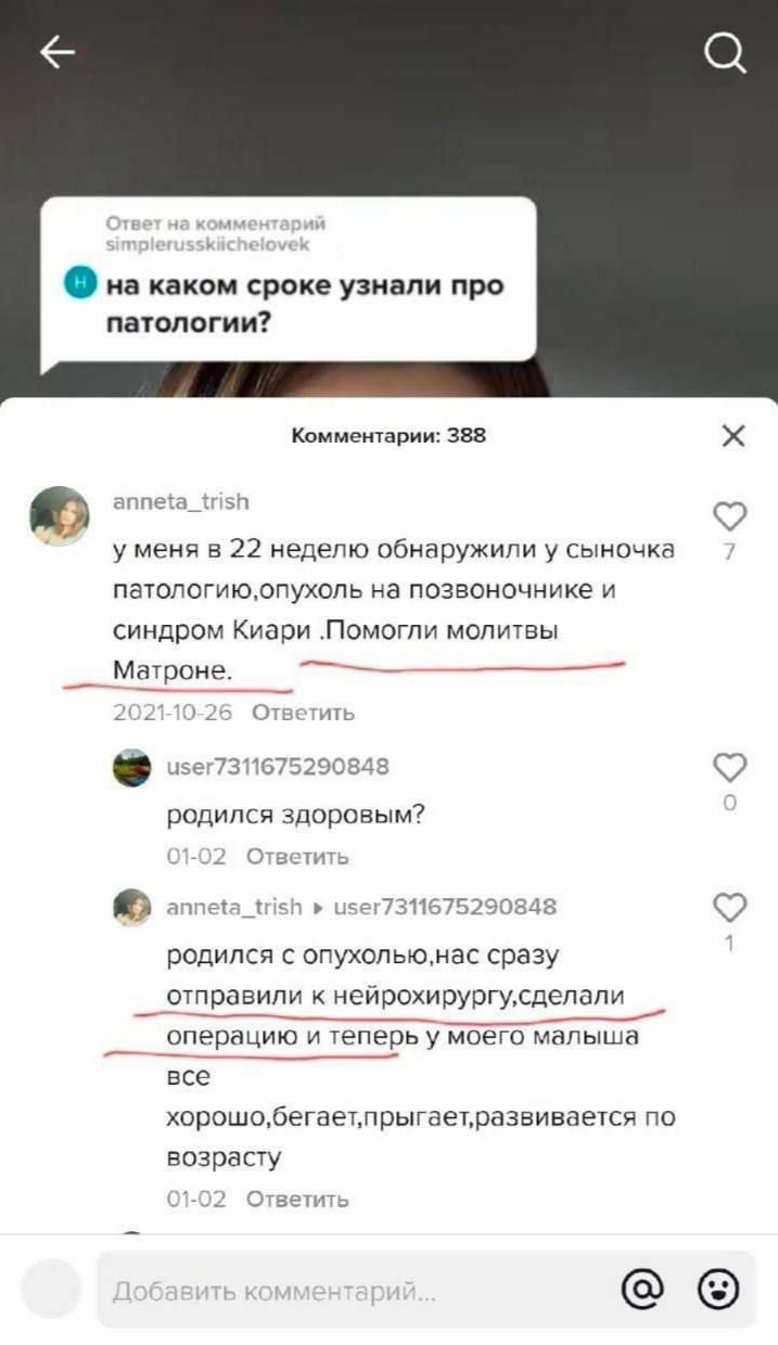на каком сроке узнали про патологии Комментарии 388 Х аппеіаді зп у меня в 22 неделю обнаружили у сыночка патологиюрпухоль на позвоночнике и синдром Киари Помогпи молитвы Матроне 7 д _ к 1 визит 75290848 родился здоровым 7 ОЕцТНТЬ лтпдтдду к1еі73116752ЧОЗЦЗ родился с опухолыонас сразу отправили нейрохирургусдепапи опероцию и теперь у моего малышо все хорошобегаетпрыгаетразвивается по возрасту ц От