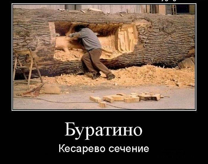 Буратино Кесарево сечение