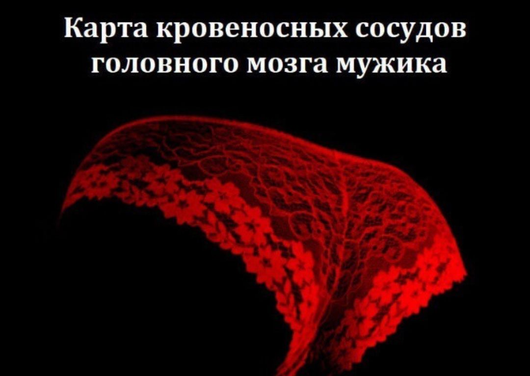 Карта кровеносных сосудов головного мозга мужика