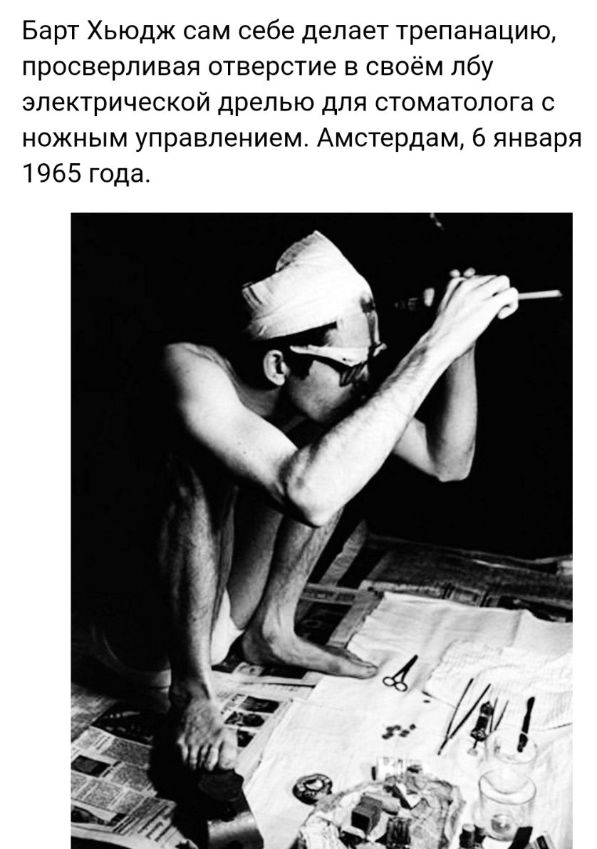 Барт Хьюдж сам себе делает трепанацию просверливая отверстие в своём лбу электрической дрелью для стоматолога с ножным управлением Амстердам 6 января 1965 года