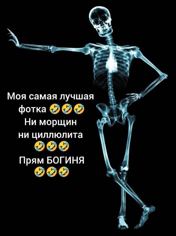Моя самая лучшая фотка 🤣🤣 Ни морщин ни цилилюлита 🤣🤣 Прям БОГИНЯ 🤣🤣