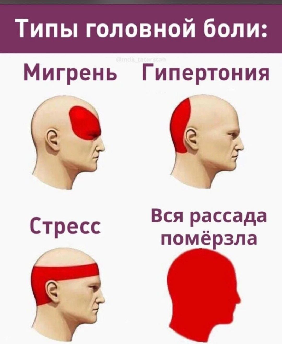 Типы головной боли Мигрень Гипертония уд Вся рассада пом_ёрзпа ЁЁ Зі Стресс