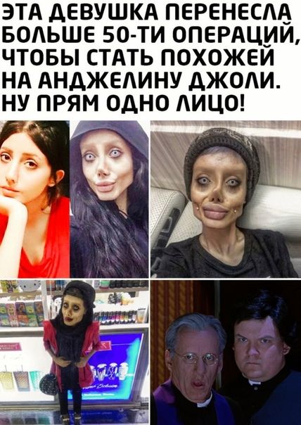 Эта девушка перенесла больше 50ти операций, чтобы стать похожей на анджелину джоли. Ну прям одно лицо!