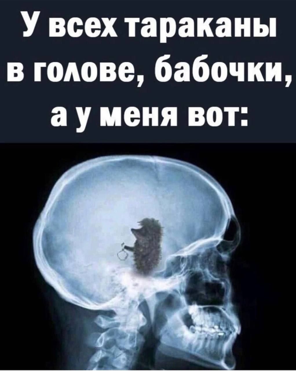 У всех тараканы в голове бабочки а у меня вот