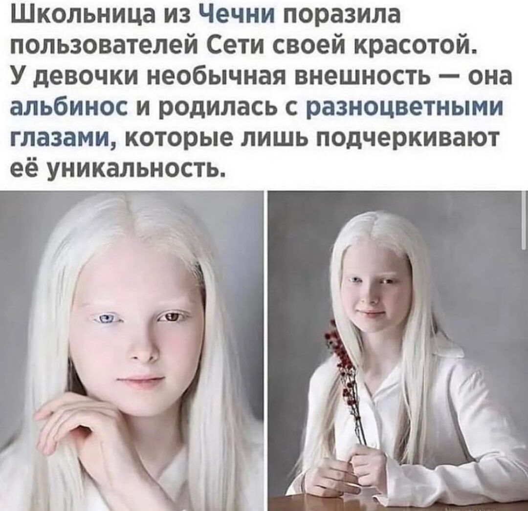 Школьница из Чечни поразила пользователей Сети своей красотой У девочки необычная внешность она альбинос и родилась с разноцветными глазами которые лишь подчеркивают её уникальность