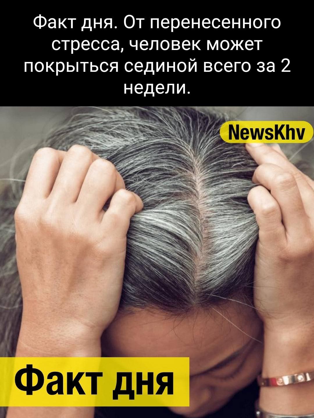 Факт дня От перенесенного стресса человек может покрыться сединой всего за 2 недели