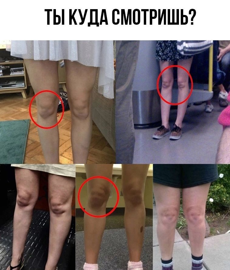 ТЫ КУДА СМПТРИШЬ