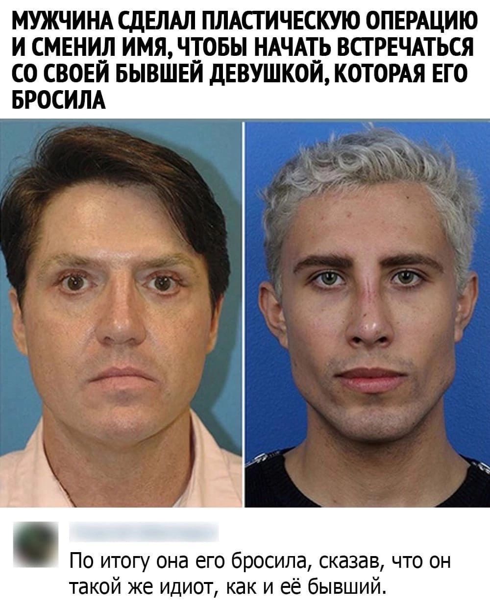 МУЖЧИНА СДЕЛАЛ ПЛАПИЧЕСКУЮ ОПЕРАЦИИ И СМЕНИЛ ИМЯЧТОБЬ НАЧАТЬ ВСТРЕЧАТЬСЯ СО СВОЕЙ БНВШЕИ дЕВУШК0ИК0ТОРАЯ ЕГО БРОСИЛА По итогу она егэ бросила сказав что он такой же идиот как и её бывший