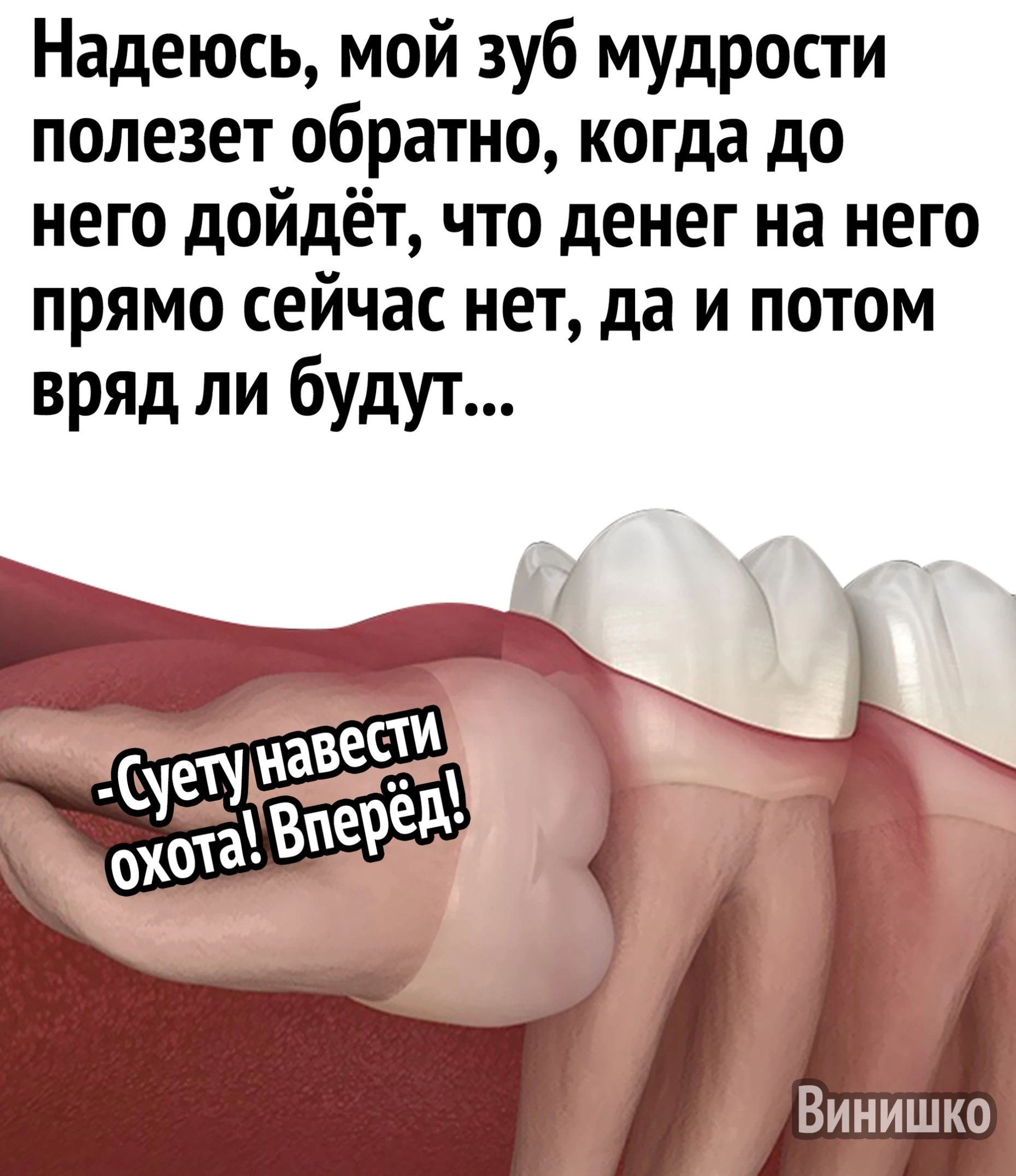 Надеюсь мой зуб мудрости полезет обратно когда до него дойдёт что денег на него прямо сейчас нет да и потом вряд ли будут Винишко