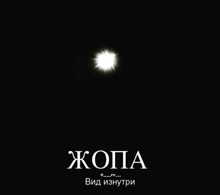 ЖОПА Вициз ЗНУТИР