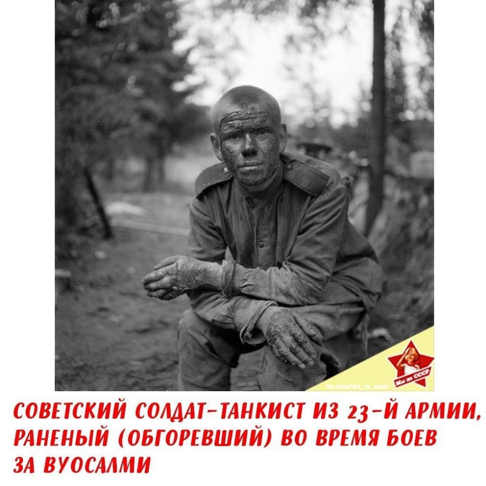 СОВЕТСКИЙ СОЛДАТТАНКИ ИЗ 23Й АРМИИ РАНЕНЫЙ ОБГОРЕВШИЙ ВО ВРЕМЯ БОЕВ ЗА ВУОСММИ