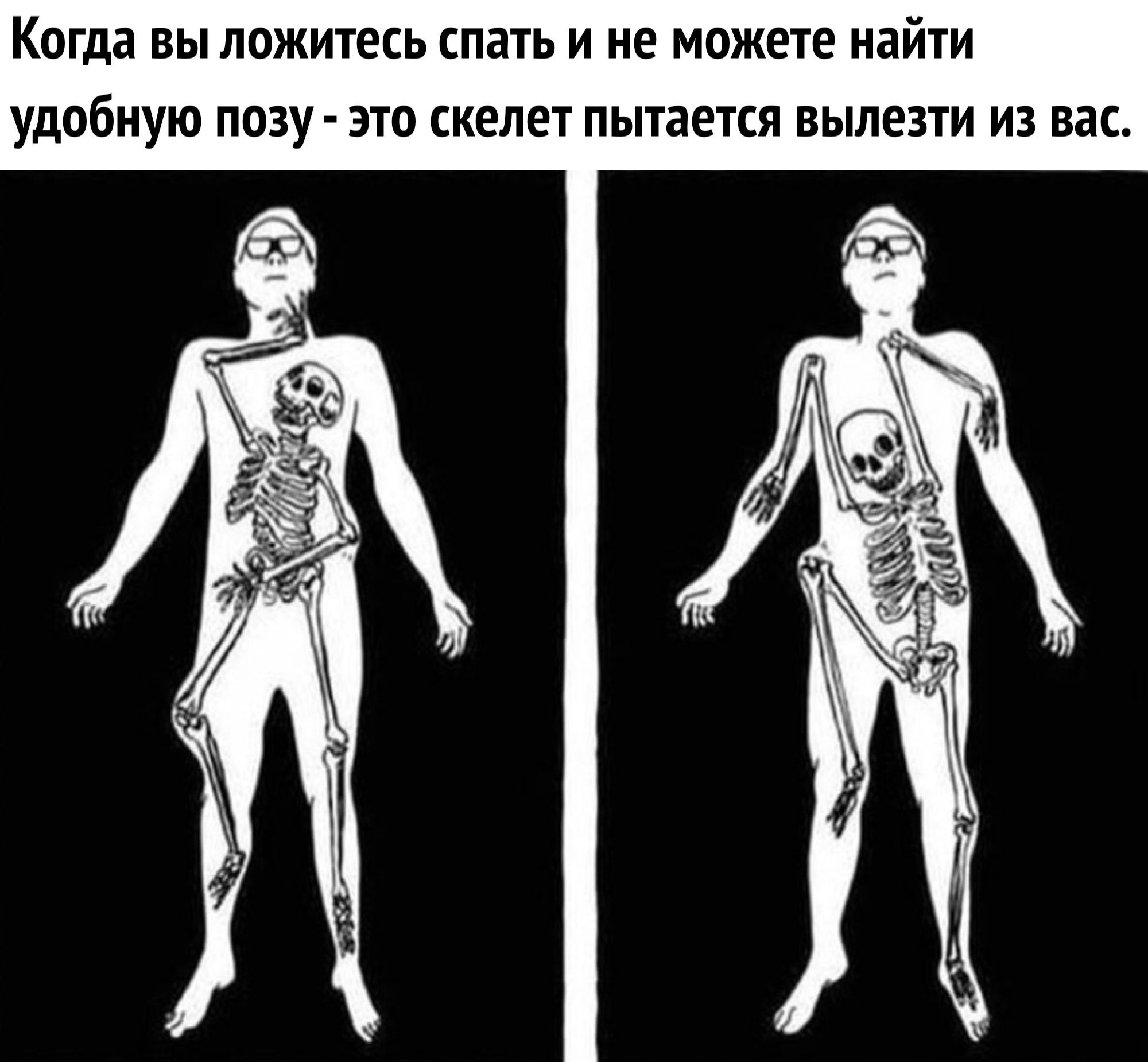 Скелет ворочается в теле