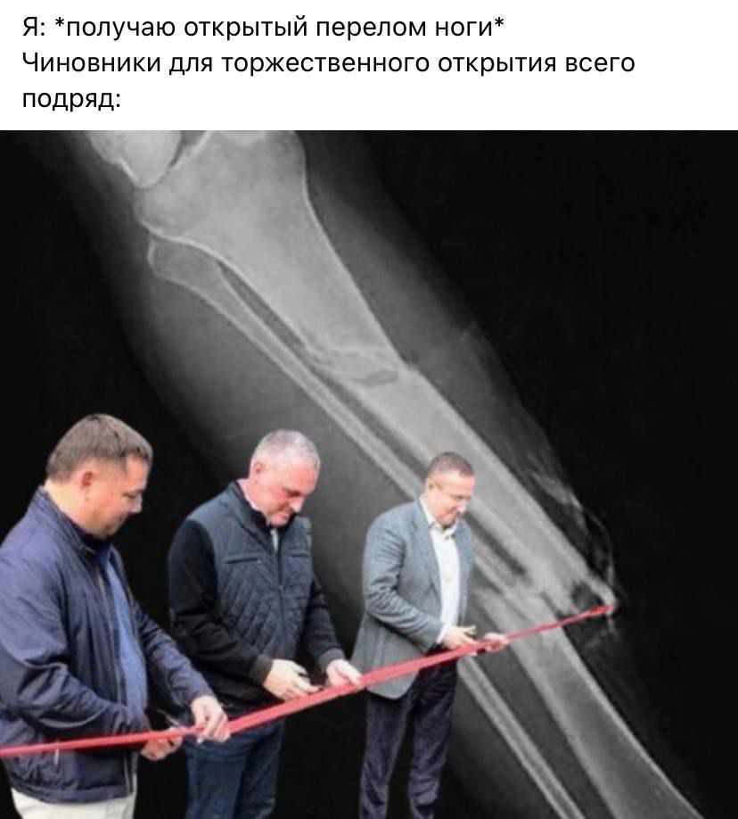 я получаю шрытыи перелом ногп Чиновники для Твржествзнного итрытпя всего подряд