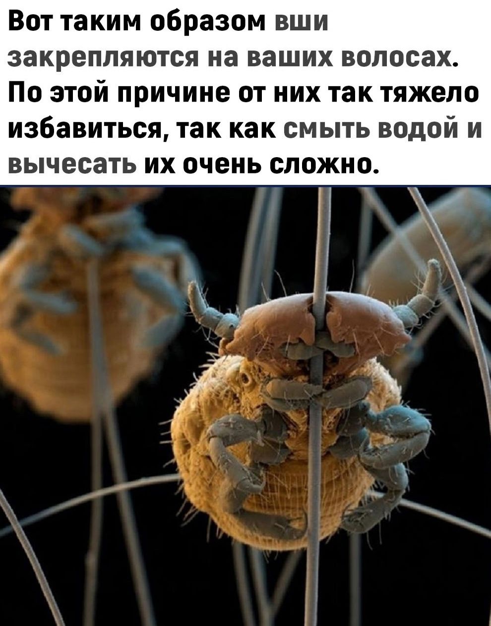 Вот таким образом вши закрепляются на ваших волосах По этой причине от них так тяжело избавиться так как смыть водой и вычесать их очень сложно