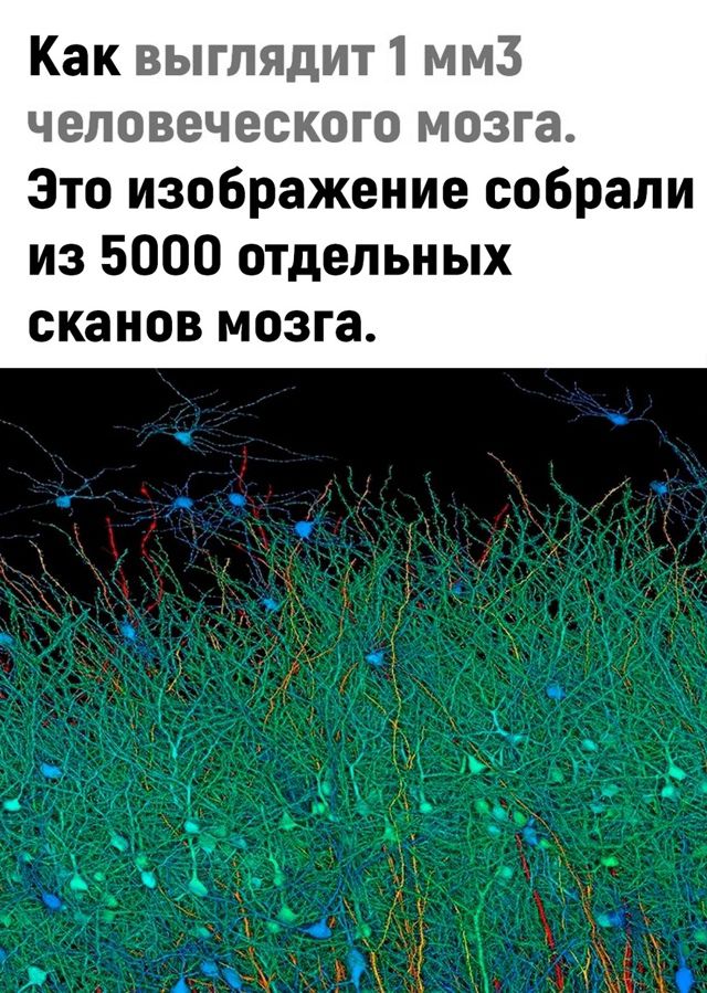 Как выглядит1 мм3 человеческого мозга Это изображение собрали из 5000 отдельных сканов мозга