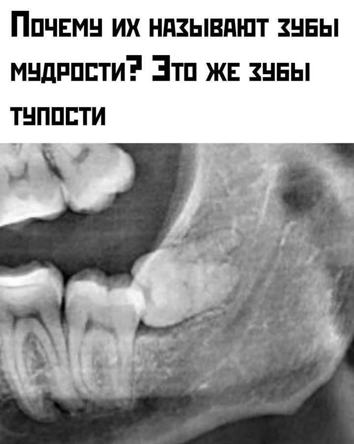 ПочеМУ их нАзЫывАЮТ хУБЫ МЧДРОСТИ Это ЖЕ ХЧБЫ тнпппти