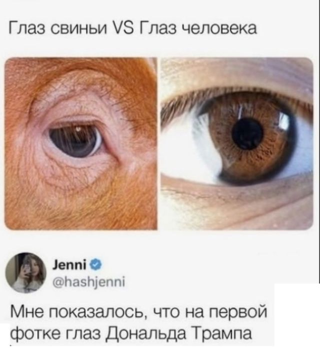 Глаз свиньи VS Глаз человека

Мне показалось, что на первой фотке глаз Дональда Трампа