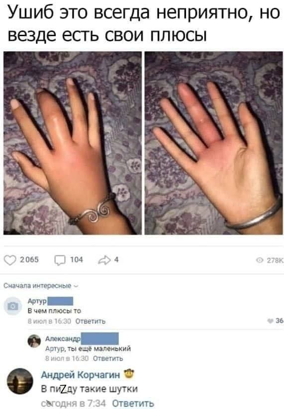 Ушиб это всегда неприятно, но везде есть свои плюсы