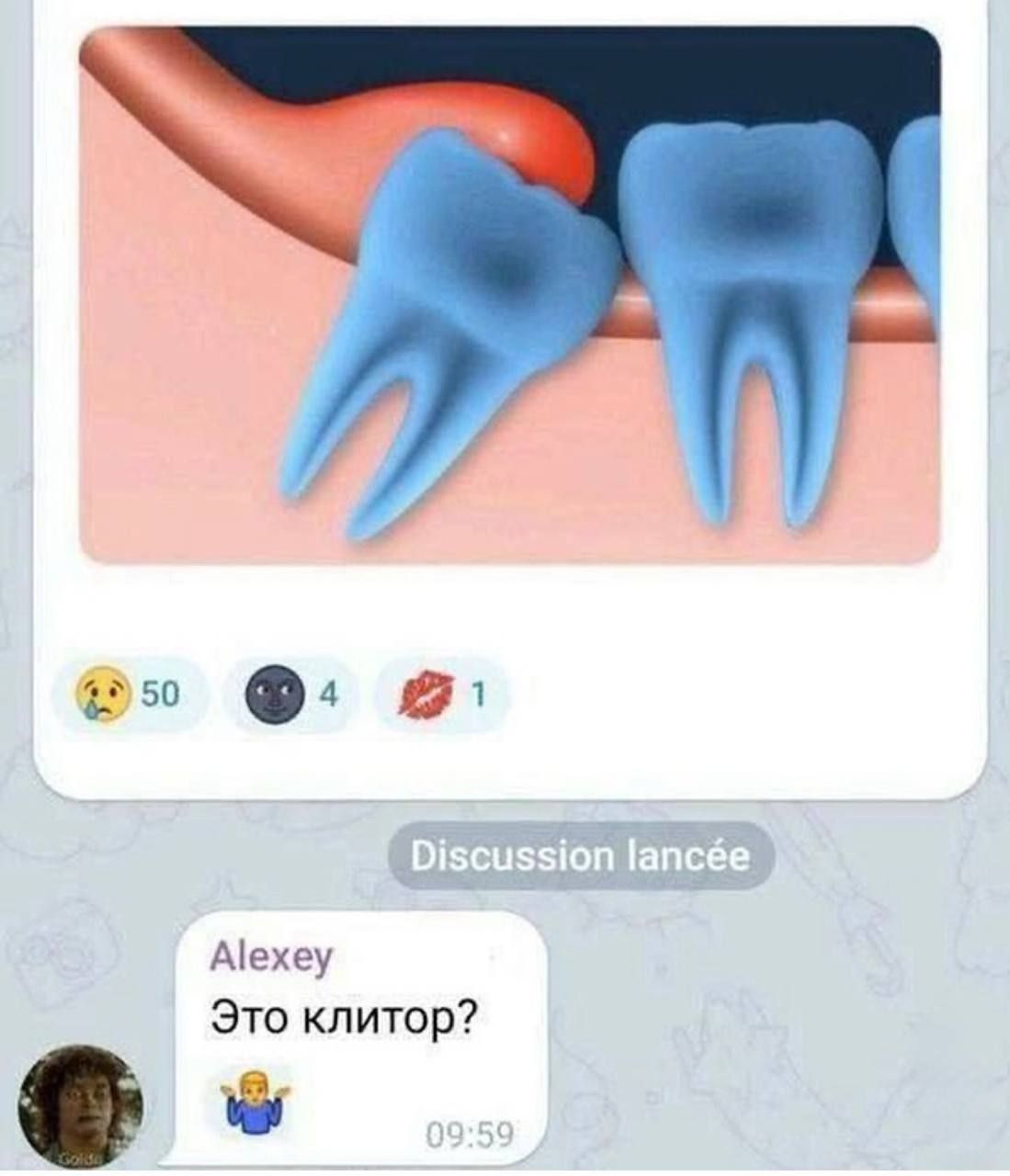 Это клитор?