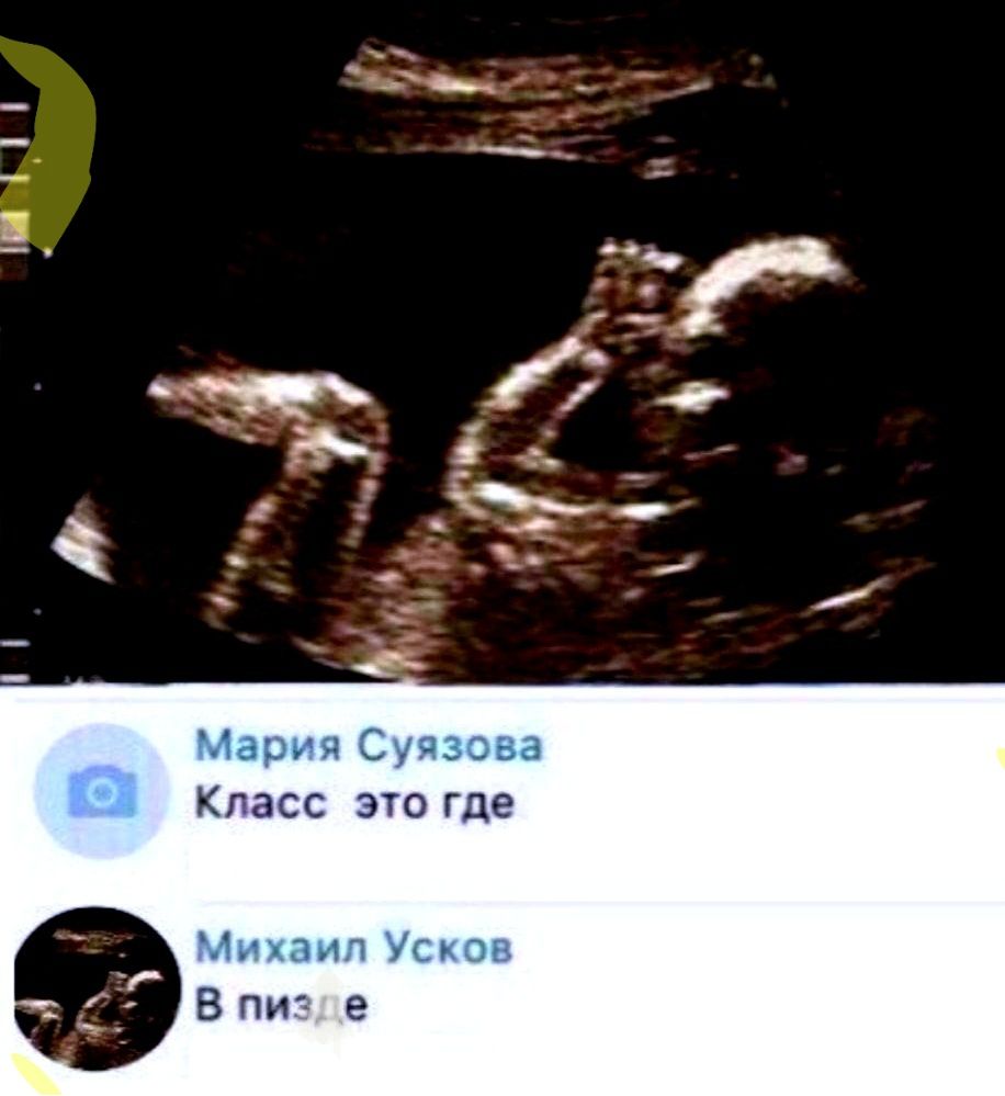 Класс это где
В пизде