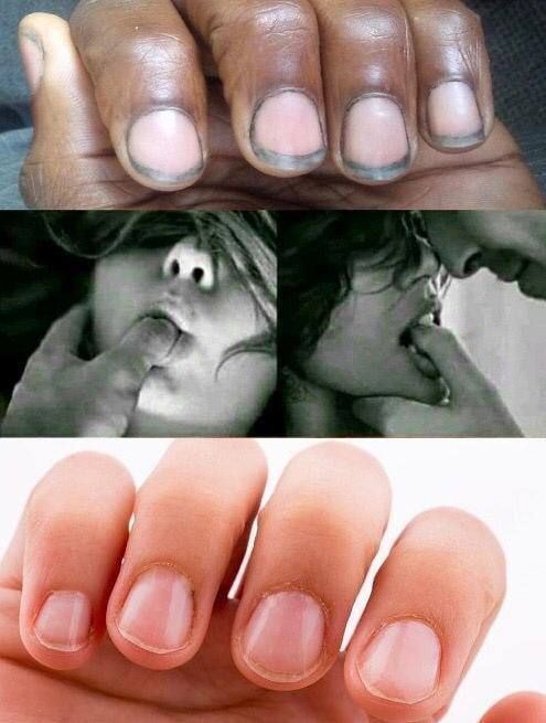 Коллаж: увеличенные ногти и черно-белые кадры людей с открытыми ртами