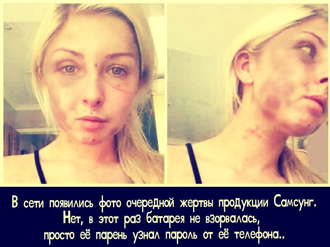 В сети появились фото очередной жертвы продукции Самсунг. Нет, в этот раз батарея не взорвалась, просто её парень узнал пароль от её телефона.