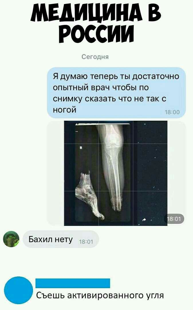 МЕДИЦИНА В РОССИИ Сегодня Я думаю теперь ты достаточно ОПЫТНЫЙ врач чтобы по снимку сказать что не так с ногой 1800 Съешь активированного угля