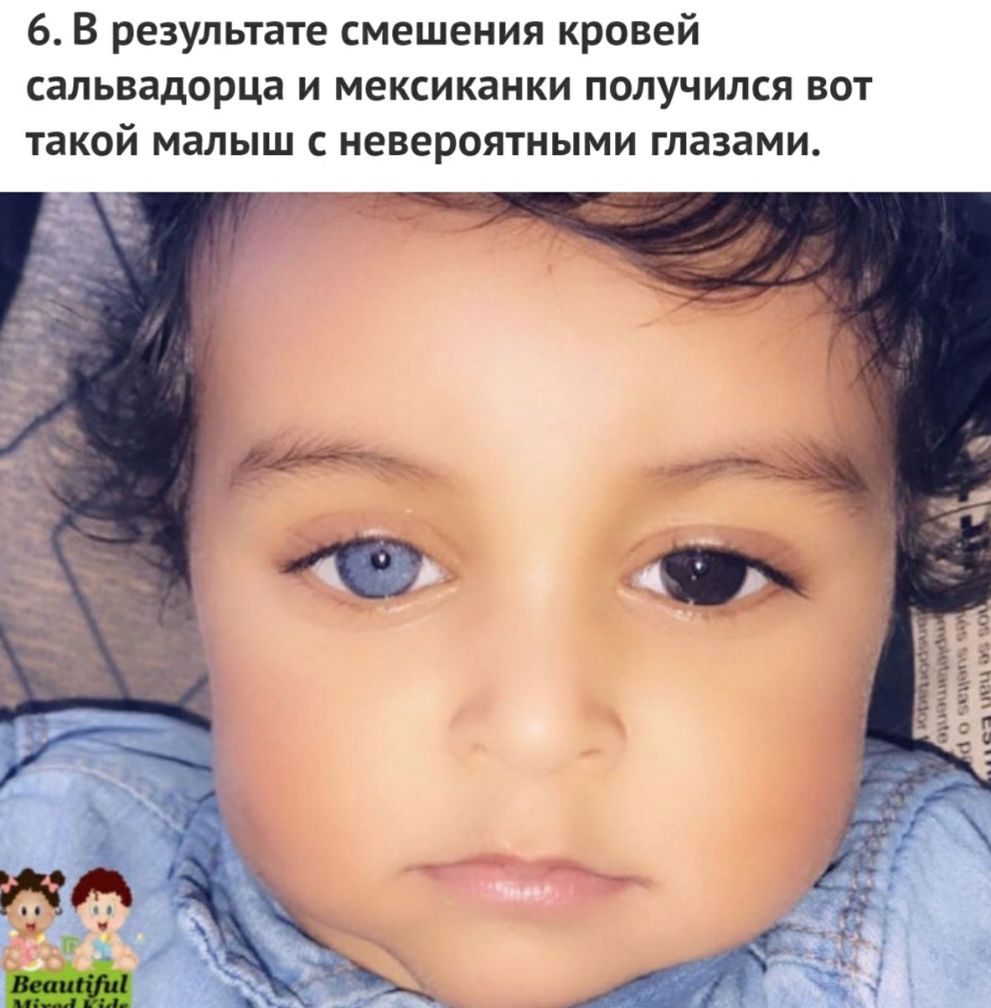 6 В результате смешения кровей сальвадорца и мексиканки получился вот такой малыш с невероятными глазами
