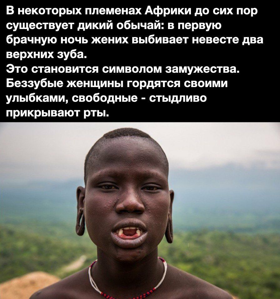 В некоторых племенах Африки до сих пор существует дикий обычай в первую брачную ночь жених выбивает невесте два верхних зуба Это становится символом замужества Беззубые женщины гордятся своими улыбками свободные стыдливо прикрывают рты