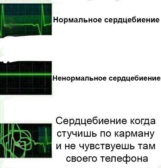 Нормальное сердцебиение Ненормальное сердцебиение Сердцебиение когда стучишь по карману и не чувствуешь там своего телефона