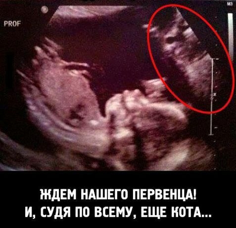 гиог ЖДЕМ НАШЕГП ПЕРВЕНЦА И СУдЯ П0 ВСЕМУ ЕЩЕ ЮТА