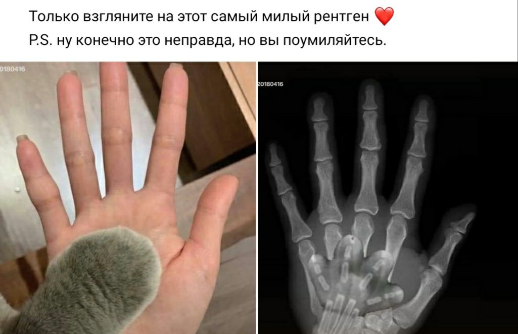 Только взгляните на этот самый милый рентген РЗ ну конечно это неправда но вы поумипяйтесь