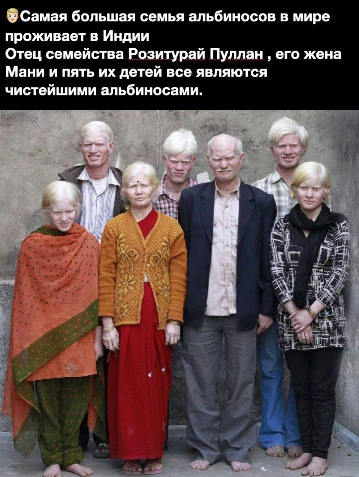 Самая большая семья апьбиносов в мире проживает в Индии Отец семейства Розитурай Пуллан его жена Мани и пять их детей все являются чистейшими альбиносами
