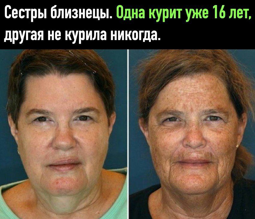 Сестры близнецы Одна курит уже 16 лет другая не курила никогда