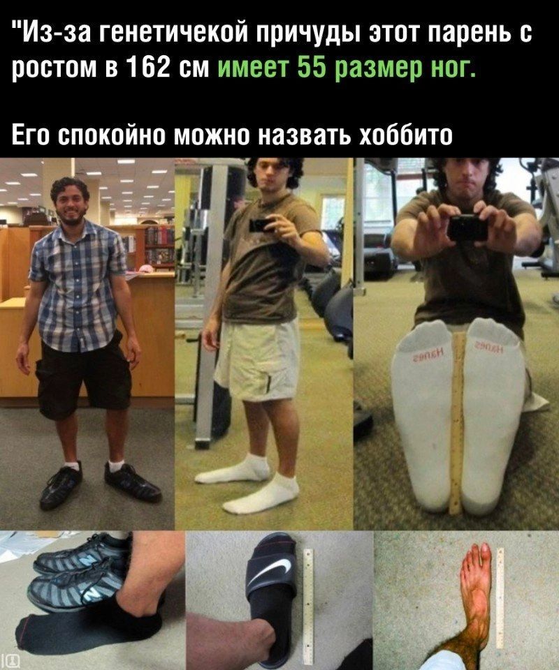 Изза геиетичекой причуды этот парень с ростом в 162 см имеет 55 размер нпг Его спокойно можно назвать хоббита