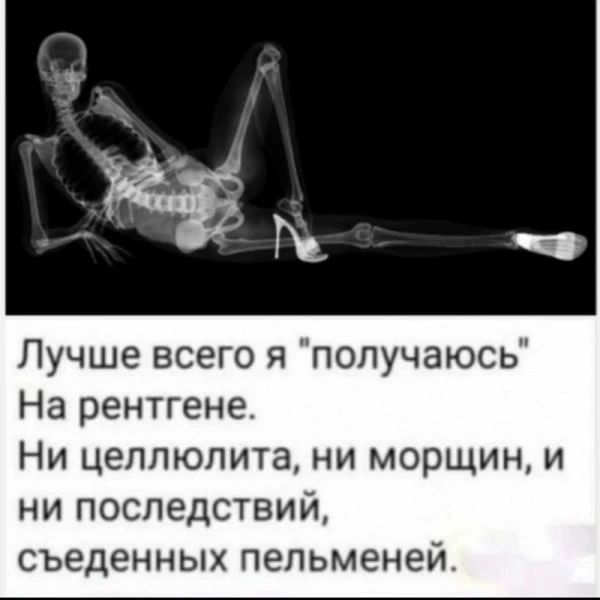Лучше всего я получаюсь На рентгене Ни целлюлита ни морщин и ни последствий съеденных пельменей