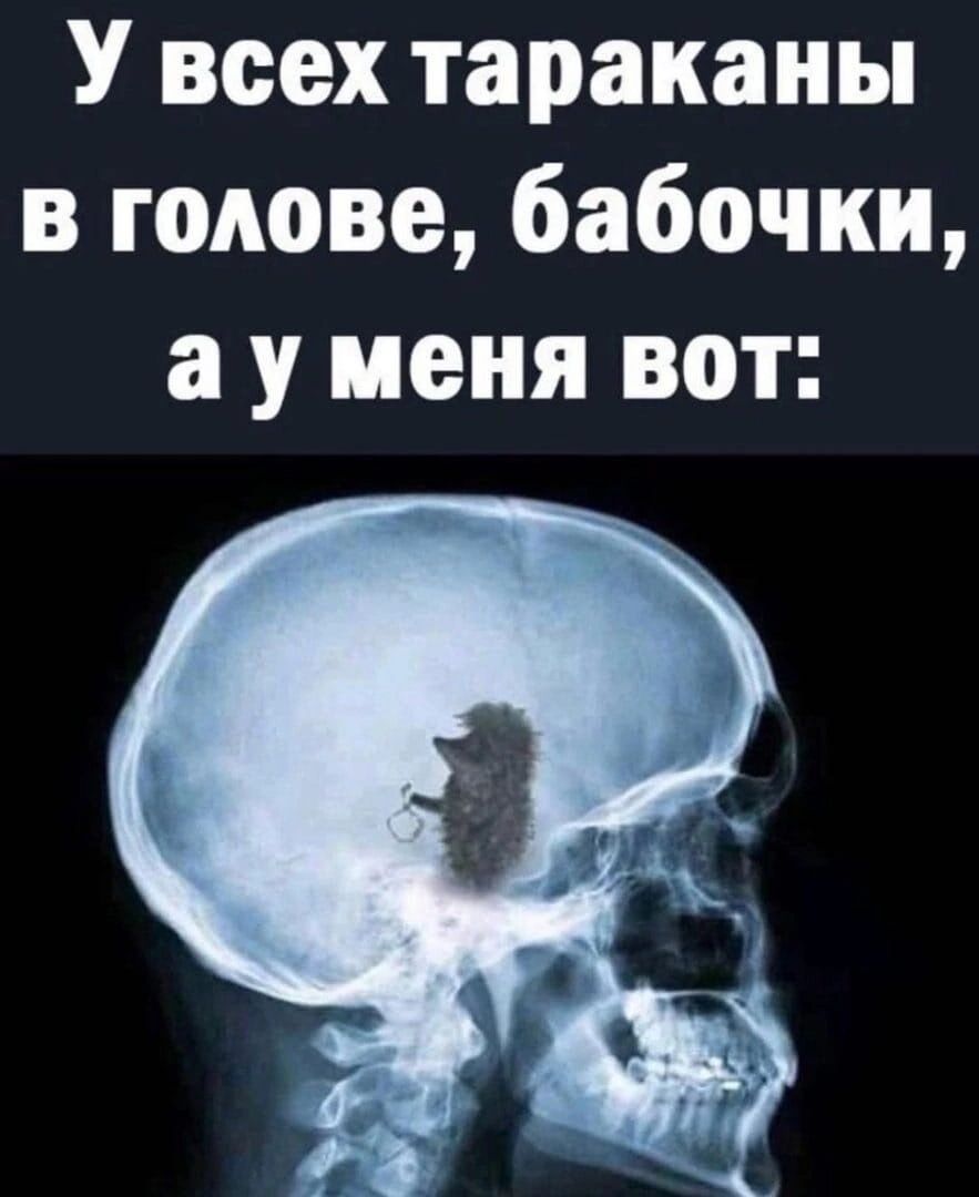 У всех тараканы в голове бабочки а у меня вот